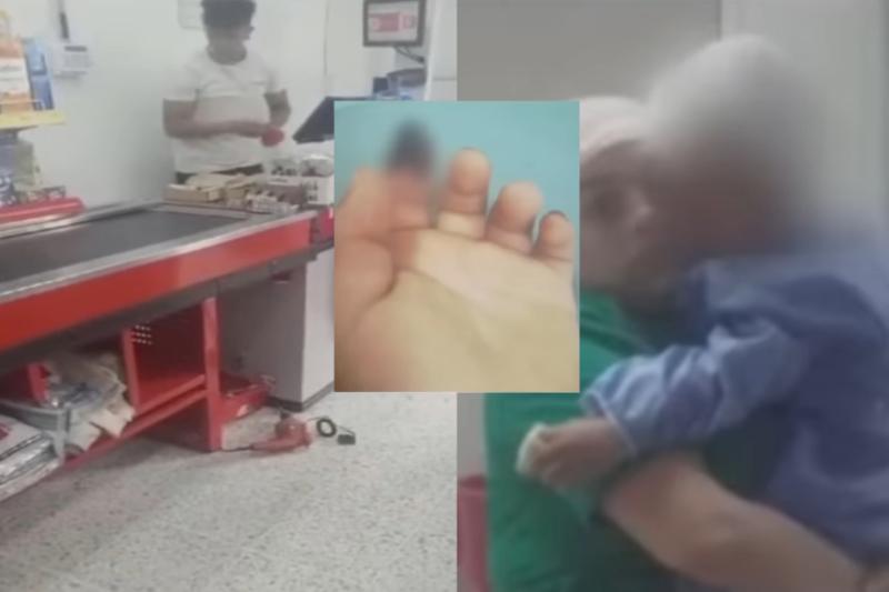 ¡Niño perdió su dedo en el supermercado! Se le atoró en la máquina de la caja registradora